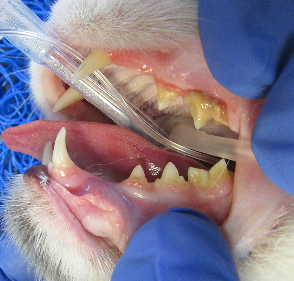 Dental Cleaning Before